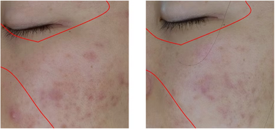 Sensitive skin soothed